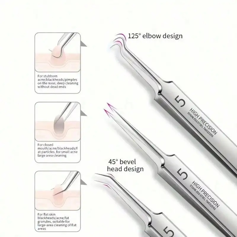 Kit d'outils pour éliminer les - Luxury Skincare Acne avis et prix